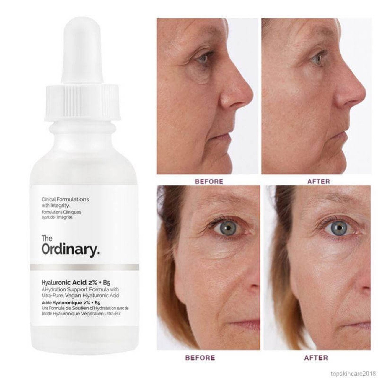 The Ordinary Hyaluronic Acid 2% + B5 – 60ml