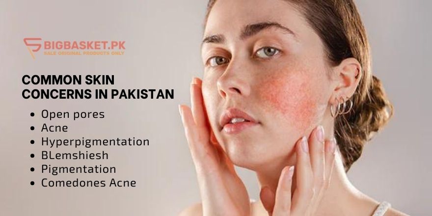 common skin concerns in Pakistan